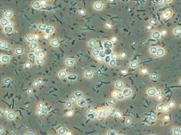 污水处理工艺选择时要考虑的7个因素